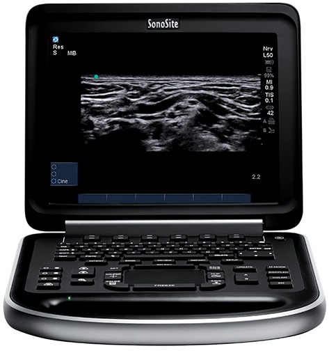 �������������� ������� Fujifilm-Sonosite Edge