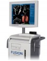 ������� Fusion ��� �������� ��� ���������������� ���������